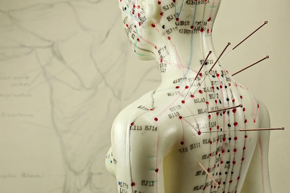 how-does-acupuncture-work